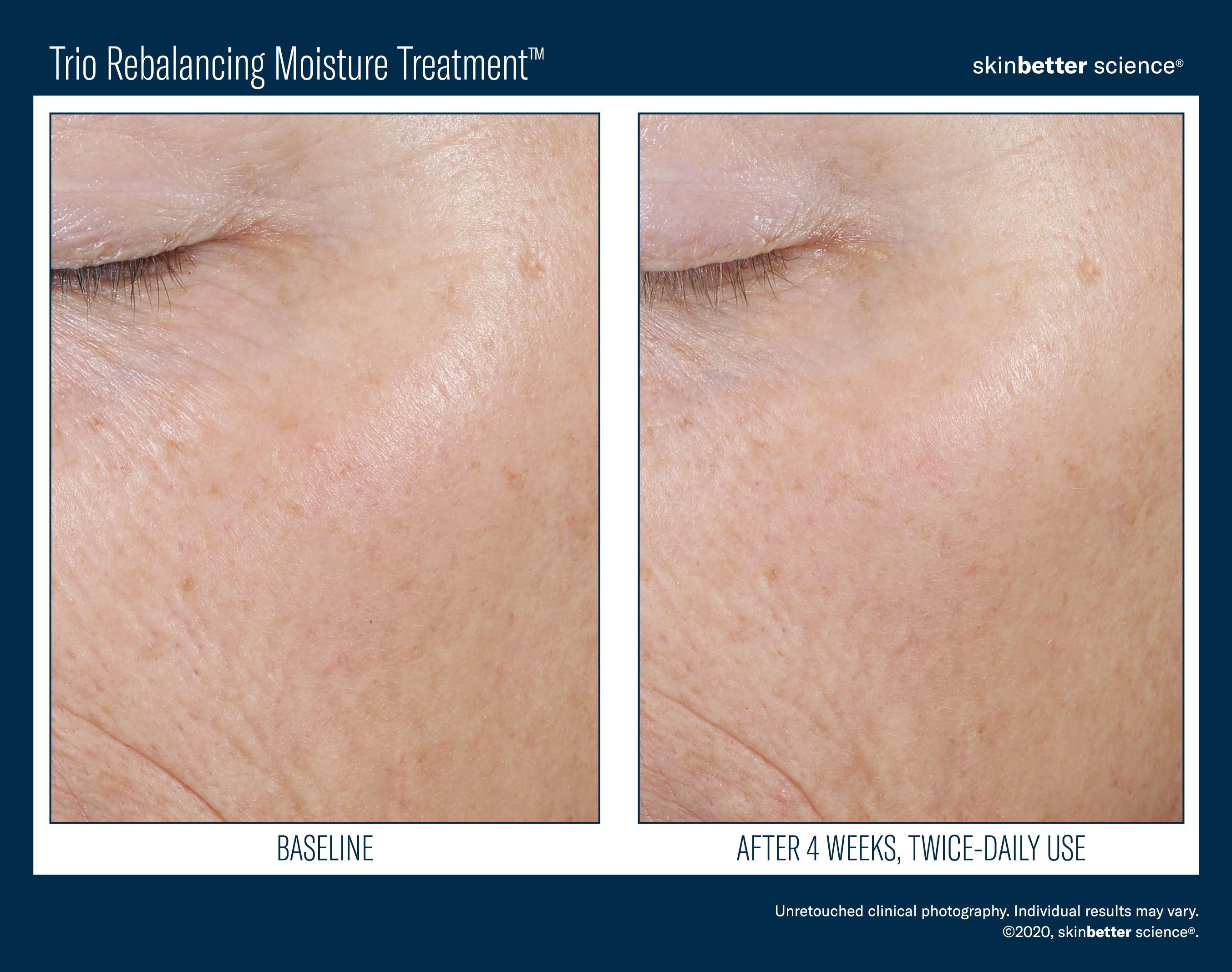 Trio Rebalancing Moisture Treatment