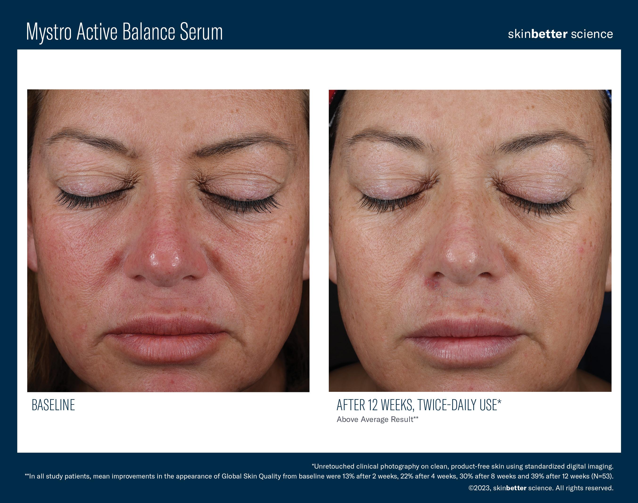 Mystro Active Balance Serum