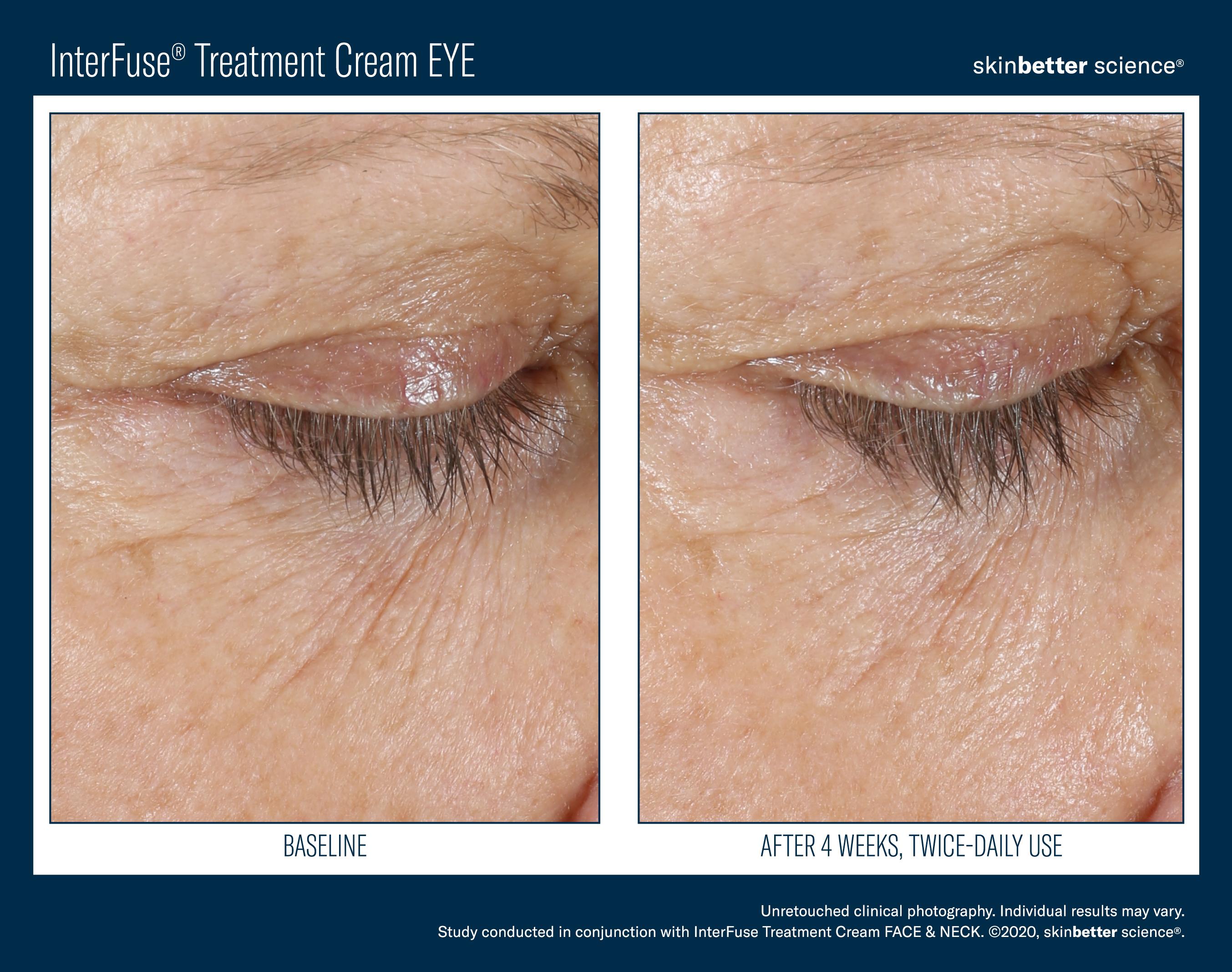 InterFuse Treatment Cream EYE