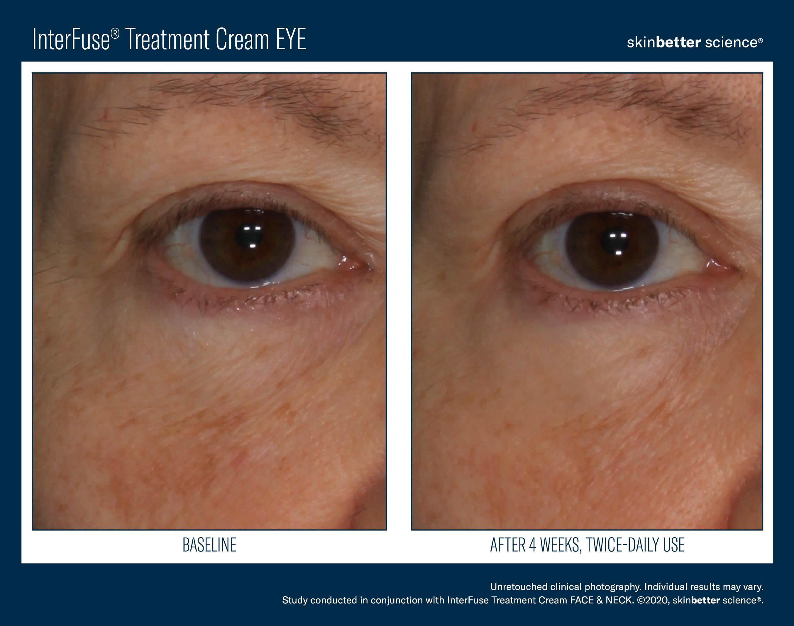 InterFuse Treatment Cream EYE