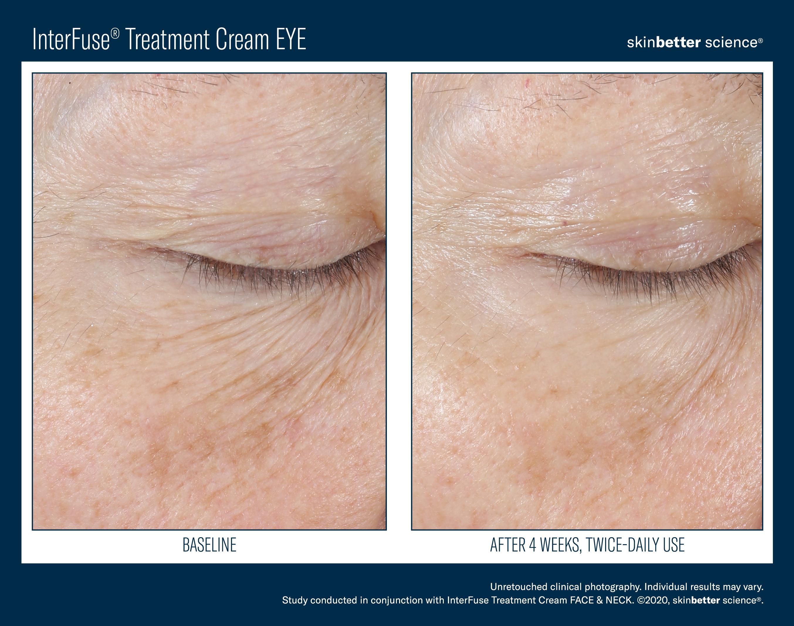 InterFuse Treatment Cream EYE