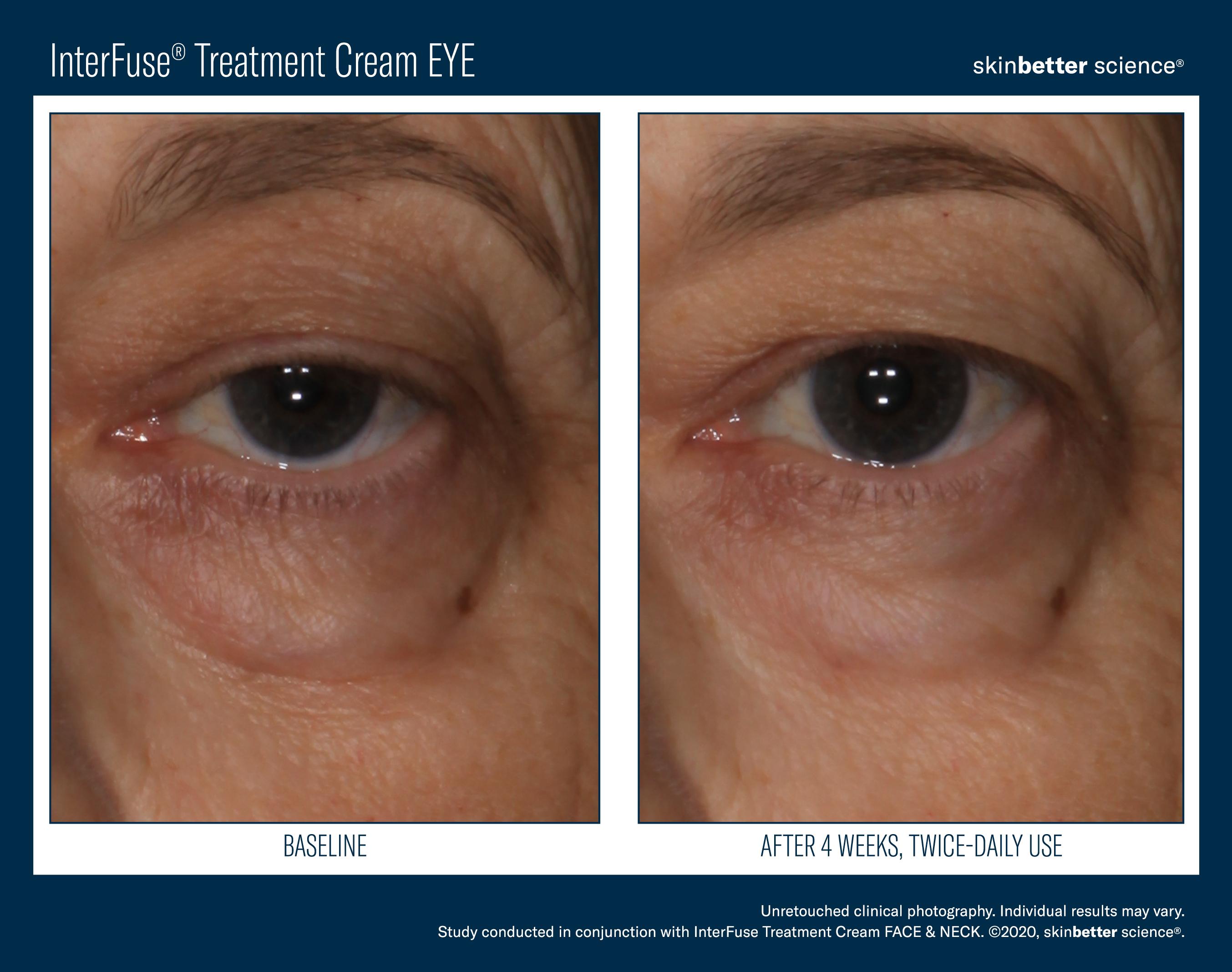 InterFuse Treatment Cream EYE