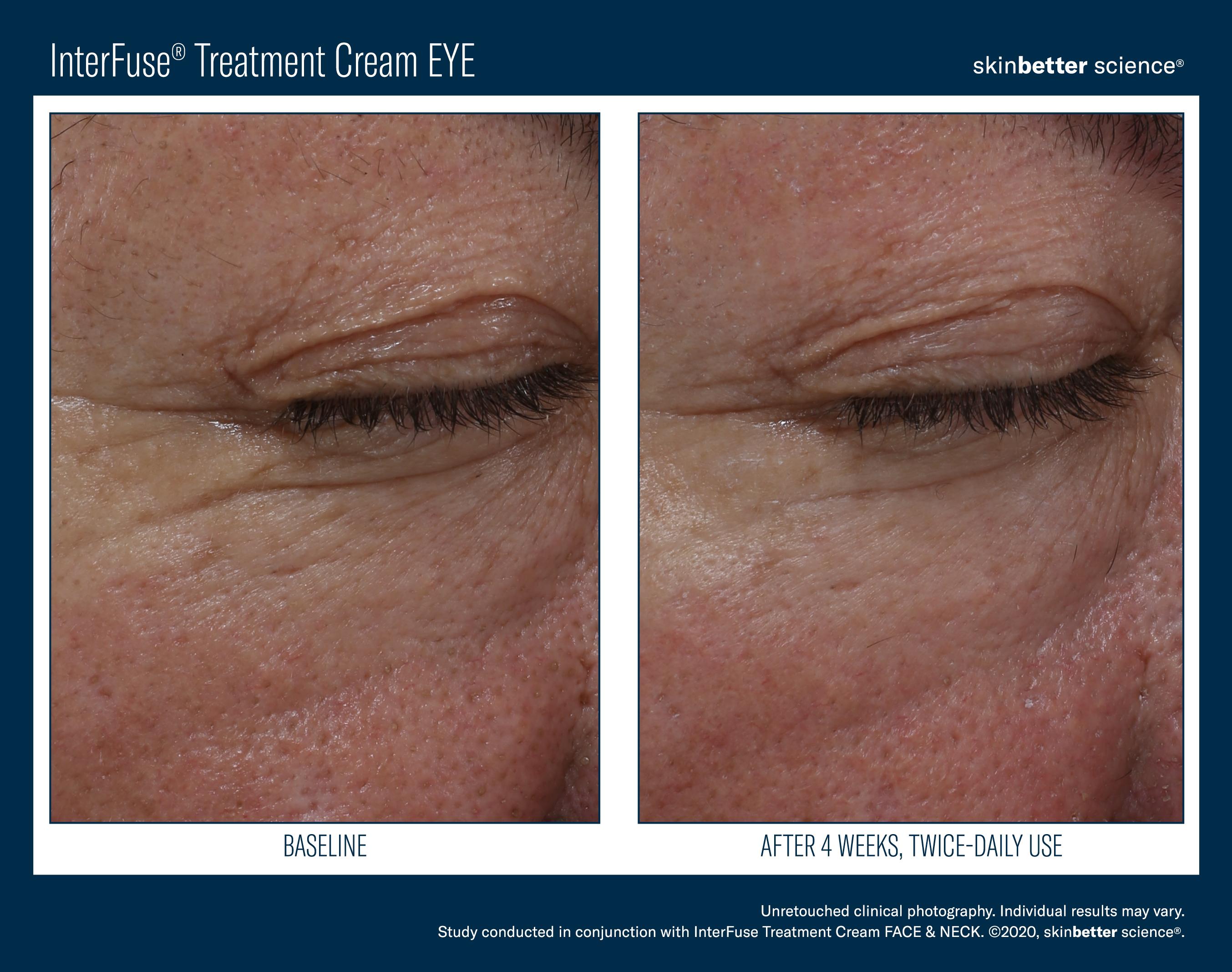 InterFuse Treatment Cream EYE