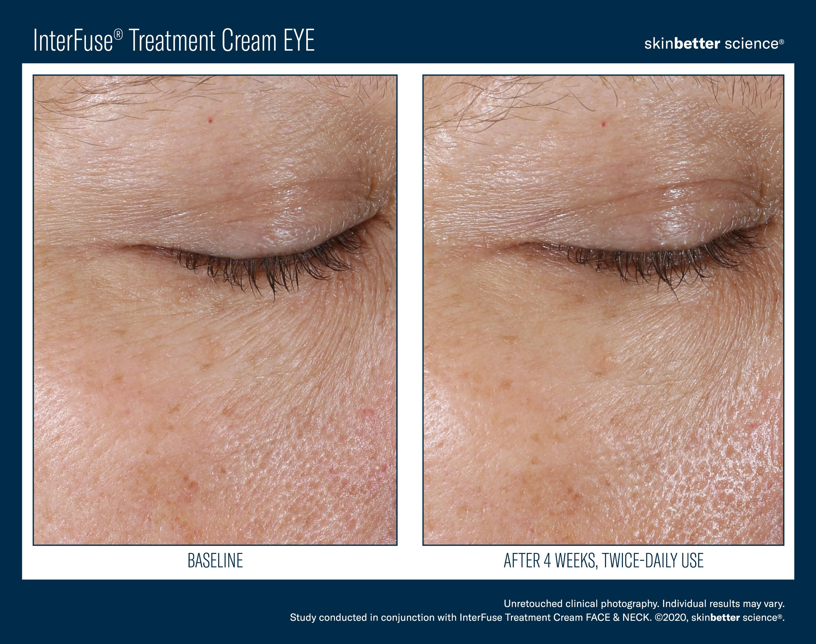 InterFuse Treatment Cream EYE