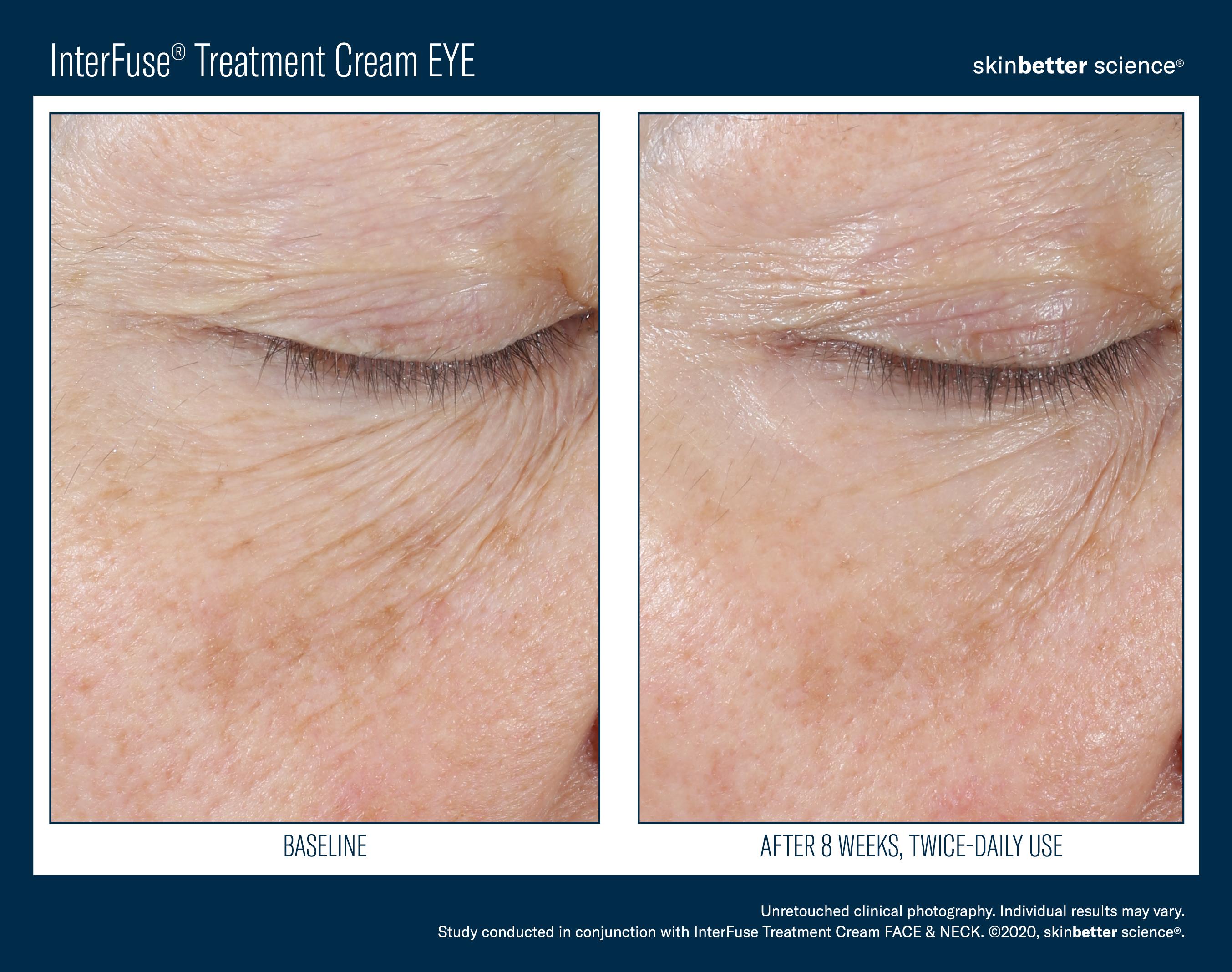 InterFuse Treatment Cream EYE