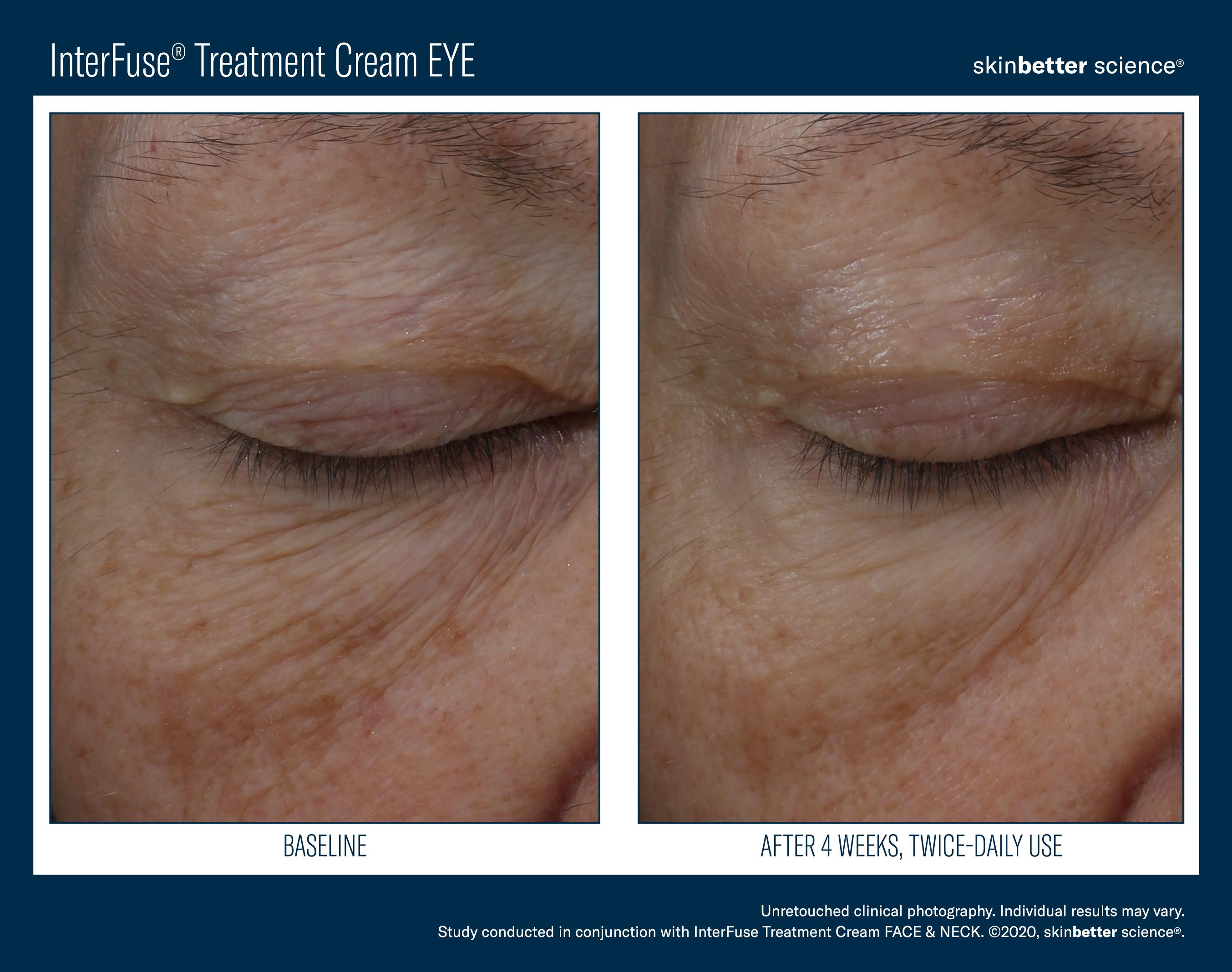 InterFuse Treatment Cream EYE